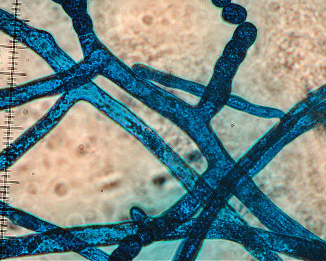 Microsope view of hyphae with blue stain applied